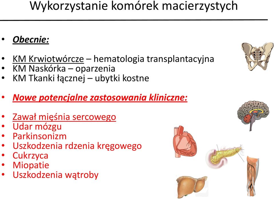 Nowe potencjalne zastosowania kliniczne: Zawał mięśnia sercowego Udar