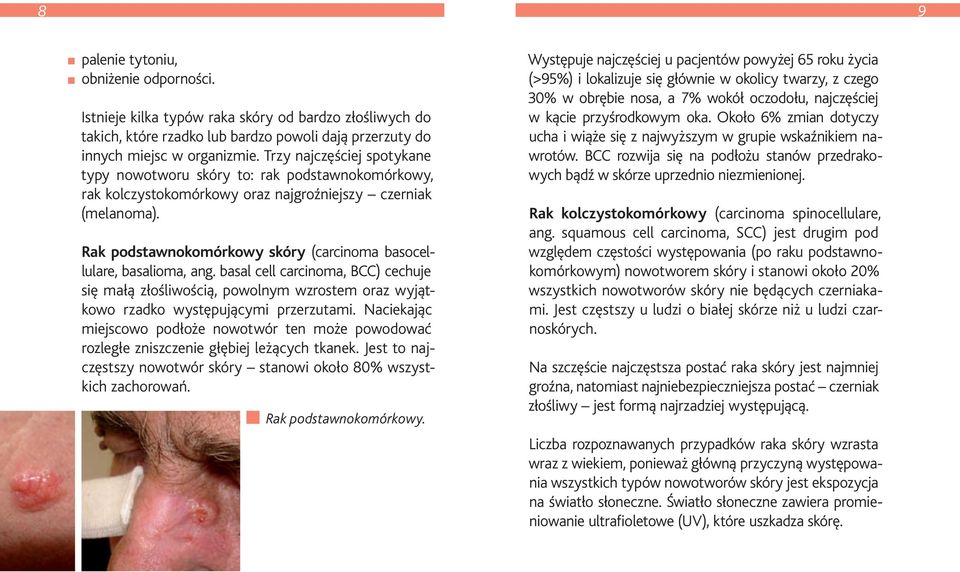 Rak podstawnokomórkowy skóry (carcinoma basocellulare, basalioma, ang. basal cell carcinoma, BCC) cechuje się małą złośliwością, powolnym wzrostem oraz wyjątkowo rzadko występującymi przerzutami.