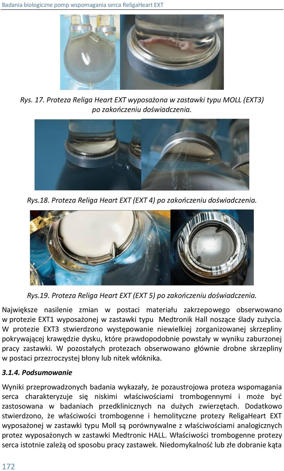 Największe nasilenie zmian w postaci materiału zakrzepowego obserwowano w protezie EXT1 wyposażonej w zastawki typu Medtronik Hall noszące ślady zużycia.