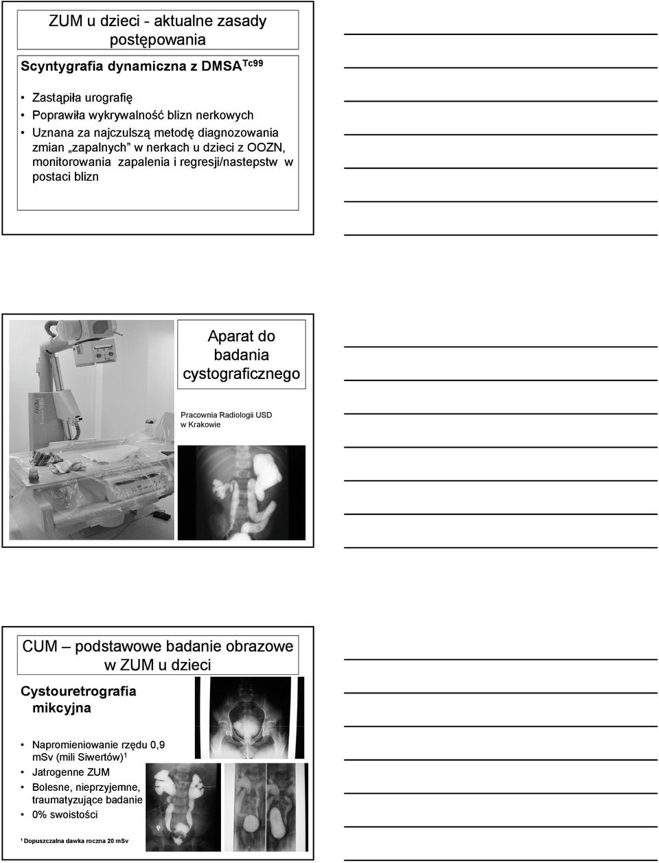 do badania cystograficznego g Pracownia Radiologii USD w Krakowie CUM podstawowe badanie obrazowe w ZUM u dzieci i Cystouretrografia mikcyjna