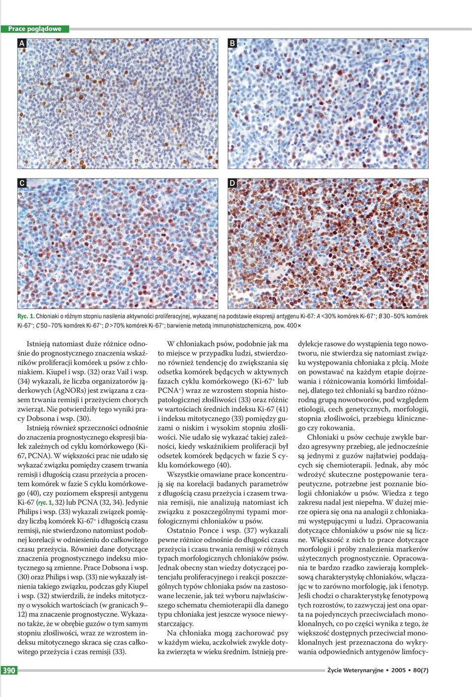 komórek Ki-67+; barwienie metodą immunohistochemiczną, pow. 400 Istnieją natomiast duże różnice odnośnie do prognostycznego znaczenia wskaźników proliferacji komórek u psów z chłoniakiem.