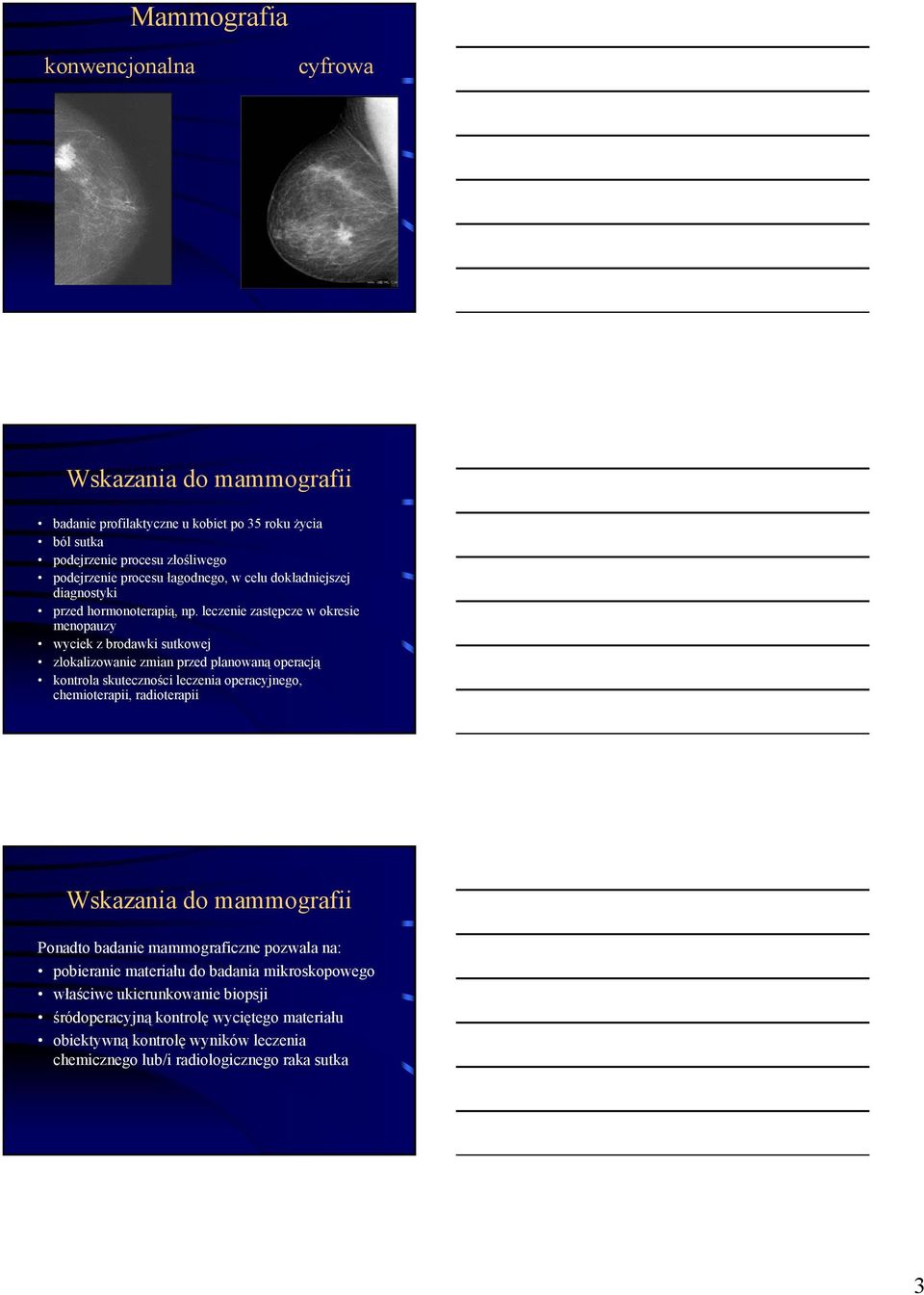 leczenie zastępcze w okresie menopauzy wyciek z brodawki sutkowej zlokalizowanie zmian przed planowaną operacją kontrola skuteczności leczenia operacyjnego, chemioterapii,