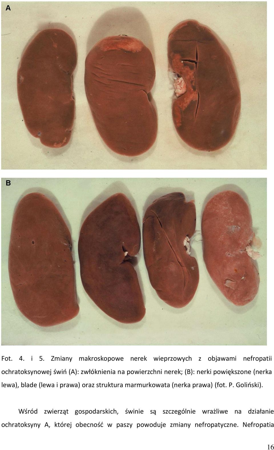 powierzchni nerek; (B): nerki powiększone (nerka lewa), blade (lewa i prawa) oraz struktura marmurkowata