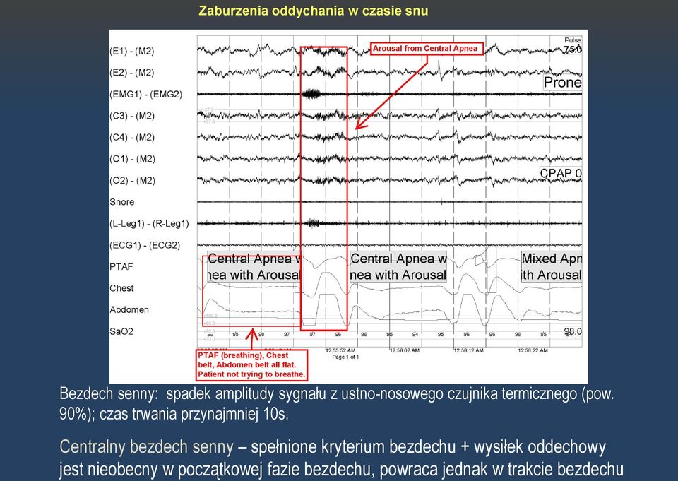 90%); czas trwania przynajmniej 10s.