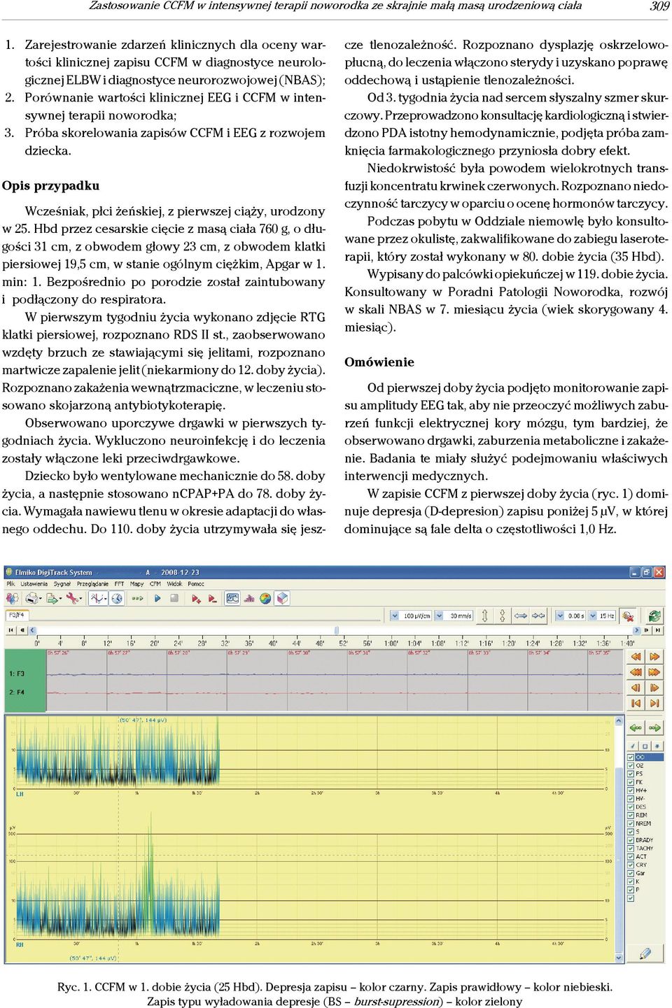 Porównanie wartości klinicznej EEG i CCFM w intensywnej terapii noworodka; 3. Próba skorelowania zapisów CCFM i EEG z rozwojem dziecka.