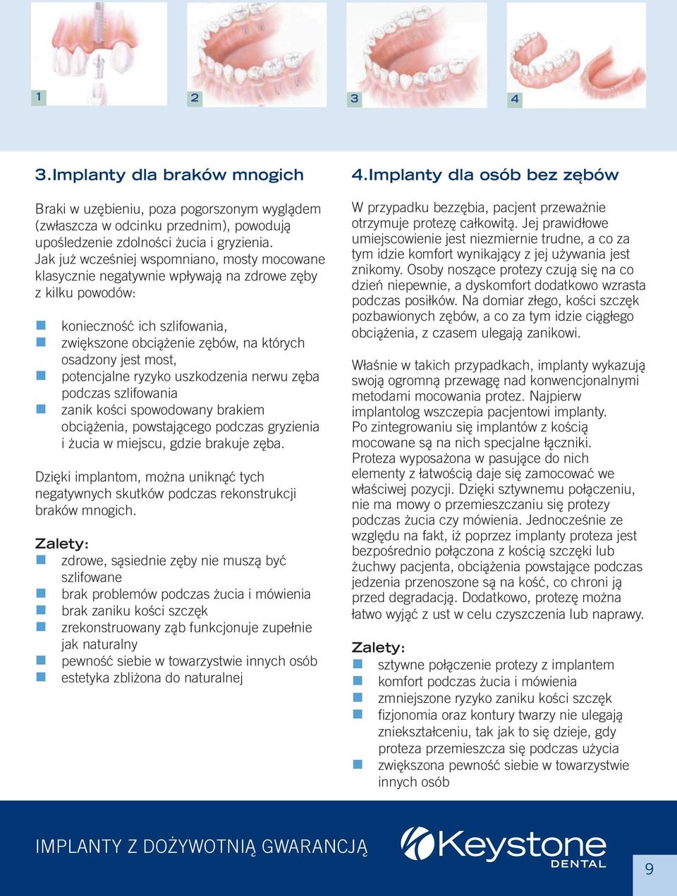 potencjalne ryzyko uszkodzenia nerwu zęba podczas szlifowania zanik kości spowodowany brakiem obciążenia, powstającego podczas gryzienia i żucia w miejscu, gdzie brakuje zęba.