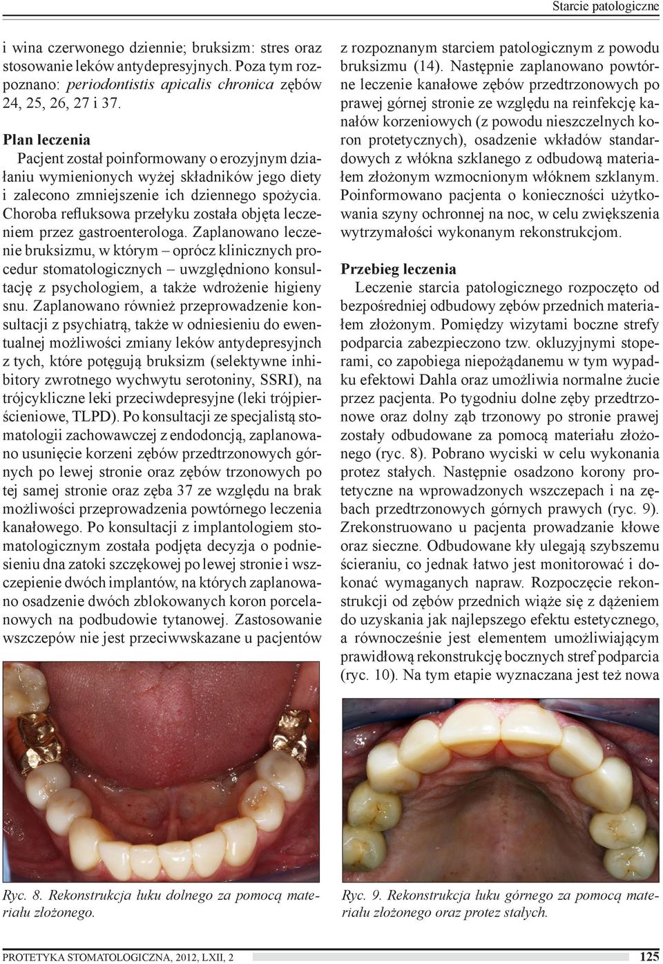 Choroba refluksowa przełyku została objęta leczeniem przez gastroenterologa.