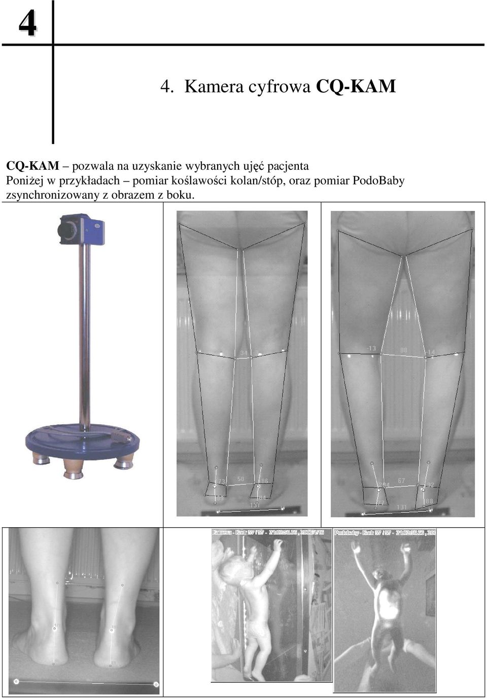 przykładach pomiar koślawości kolan/stóp, oraz