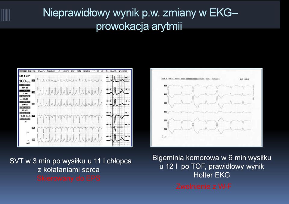 min po wysiłku u 11 l chłopca z kołataniami serca