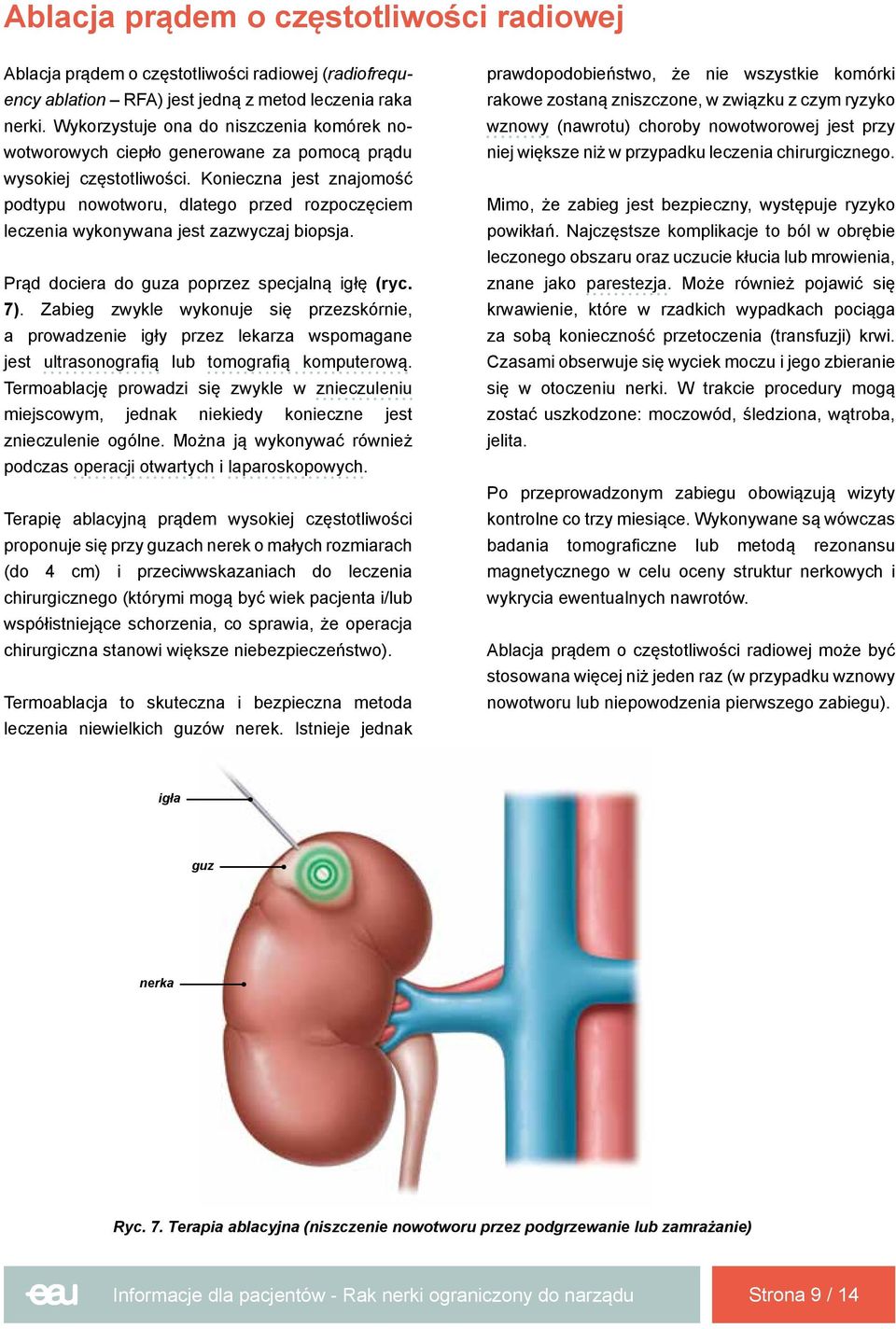 Konieczna jest znajomość podtypu nowotworu, dlatego przed rozpoczęciem leczenia wykonywana jest zazwyczaj biopsja. Prąd dociera do guza poprzez specjalną igłę (ryc. 7).