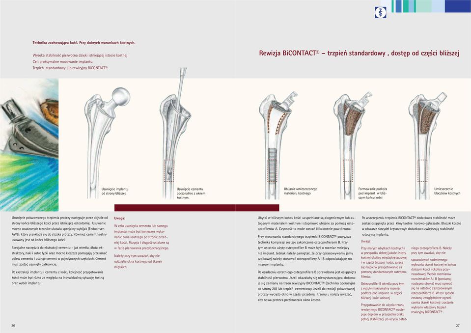 Ubijanie umieszczonego materiału kostnego Formowanie podłoża pod implant w bliższym końcu kości Umieszczenie bloczków kostnych Usunięcie poluzowanego trzpienia protezy następuje przez dojście od