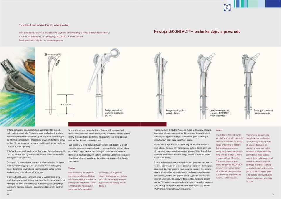 Mostowanie stref ubytku i wtórna osteogeneza. Rewizja BiCONTACT technika dojścia przez udo min. 100 mm Dostęp przez-udowy i usunięcie poluzowanej protezy. Przygotowanie podłoża w części dalszej.