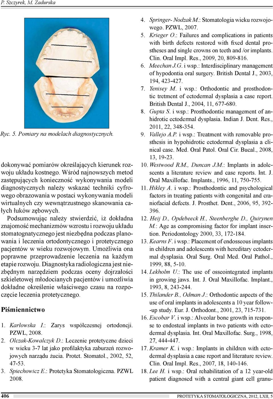 skanowania całych łuków zębowych.