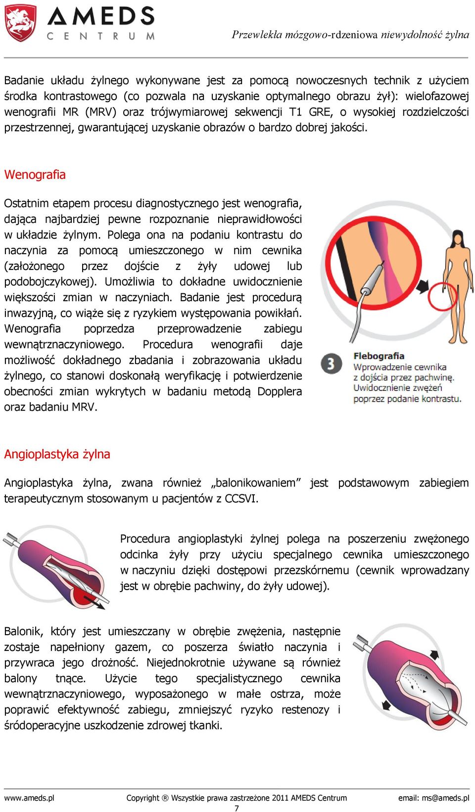 Wenografia Ostatnim etapem procesu diagnostycznego jest wenografia, dająca najbardziej pewne rozpoznanie nieprawidłowości w układzie żylnym.
