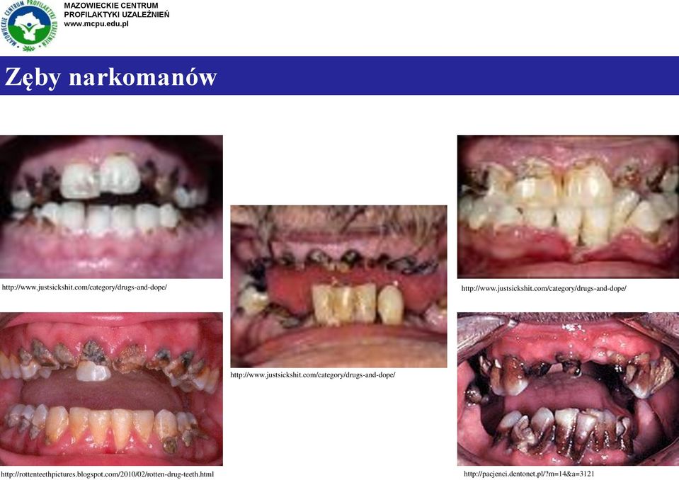 com/category/drugs-and-dope/ http://rottenteethpictures.blogspot.