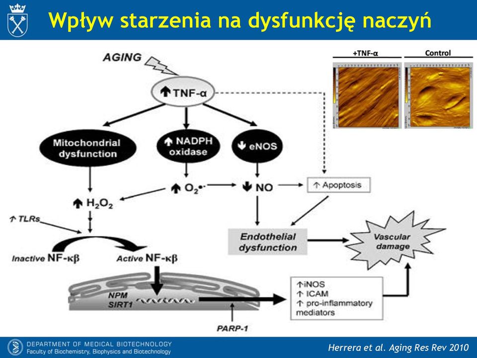 naczyń Herrera et