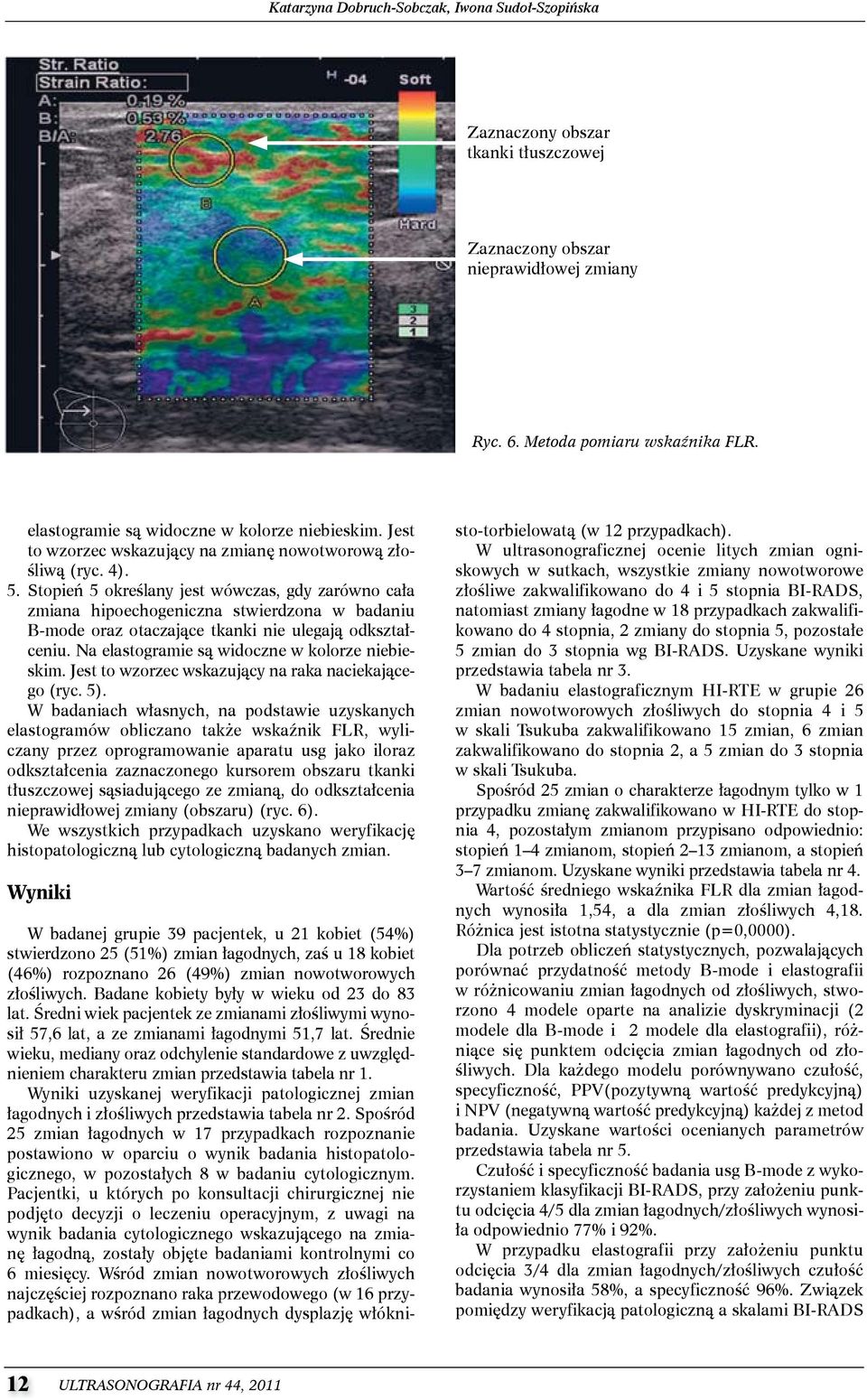 stopień 5 określany jest wówczas, gdy zarówno cała zmiana hipoechogeniczna stwierdzona w badaniu B-mode oraz otaczające tkanki nie ulegają odkształceniu.