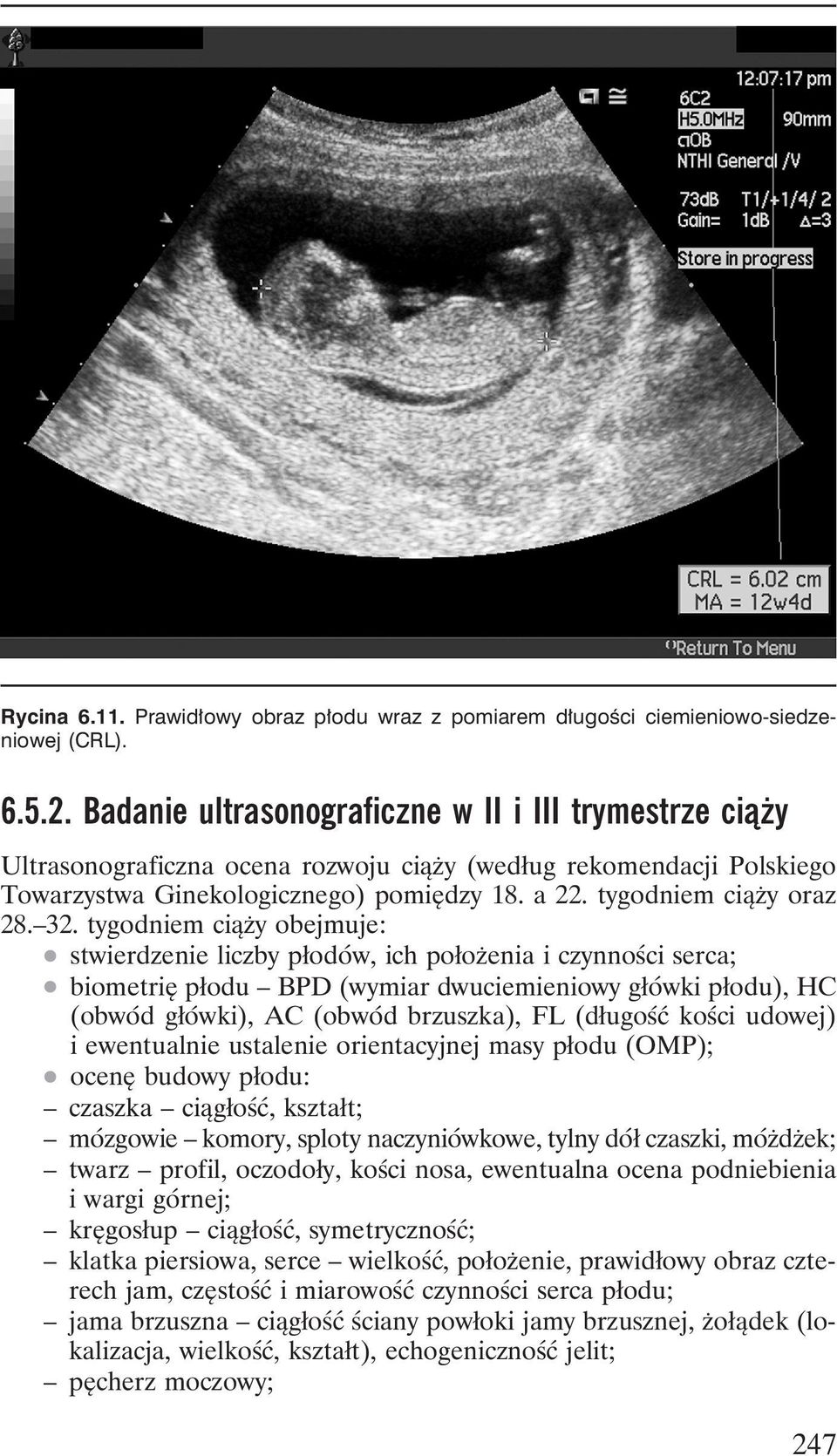 tygodniem cia z y oraz 28. 32. tygodniem cia z y obejmuje:. stwierdzenie liczby płodo w, ich połoz enia i czynnos ci serca;.