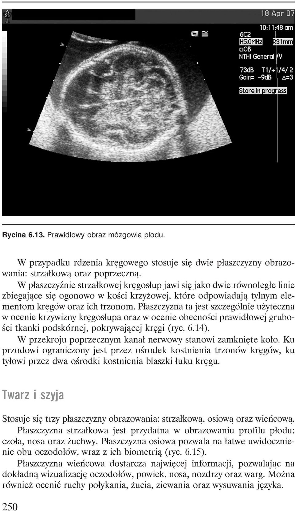 Płaszczyzna ta jest szczególnie użyteczna w ocenie krzywizny kręgosłupa oraz w ocenie obecności prawidłowej grubości tkanki podskórnej, pokrywającej kręgi (ryc. 6.14).