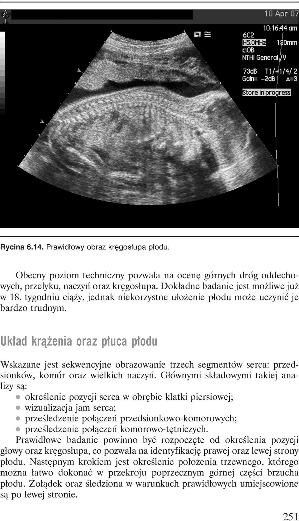 Układ krążenia oraz płuca płodu Wskazane jest sekwencyjne obrazowanie trzech segmentów serca: przedsionków, komór oraz wielkich naczyń. Głównymi składowymi takiej analizy są:.