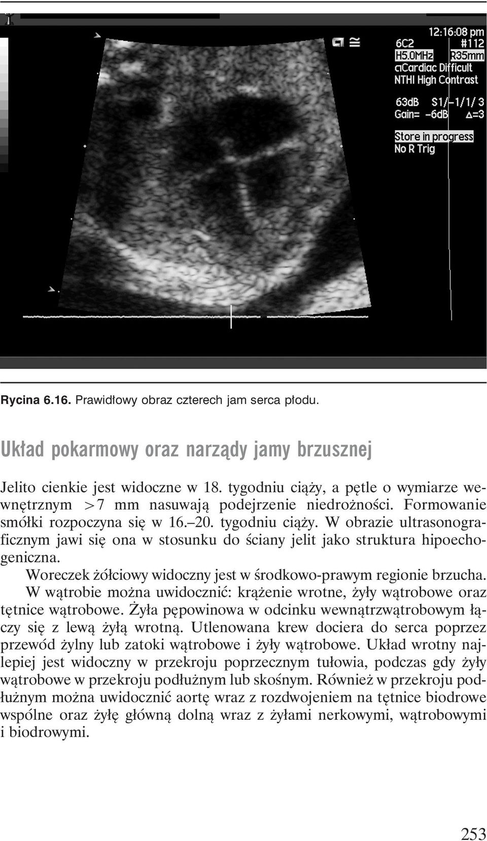 W obrazie ultrasonograficznym jawi się ona w stosunku do ściany jelit jako struktura hipoechogeniczna. Woreczek żółciowy widoczny jest w środkowo-prawym regionie brzucha.