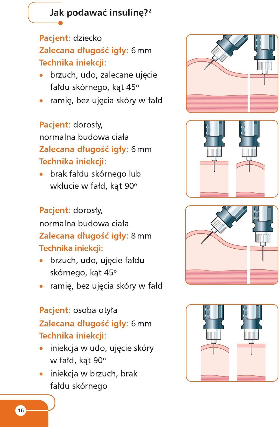 Pacjent: dorosły, normalna budowa ciała Zalecana długość igły: 6 mm Technika iniekcji: brak fałdu skórnego lub wkłucie w fałd, kąt 90 o Pacjent: dorosły,