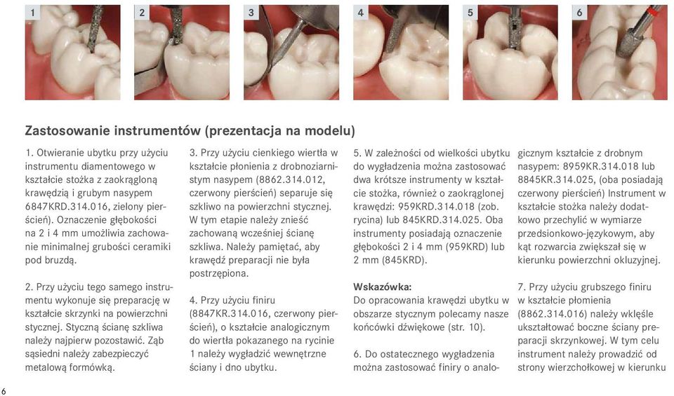 Styczną ścianę szkliwa należy najpierw pozostawić. Ząb sąsiedni należy zabezpieczyć metalową formówką. 3. Przy użyciu cienkiego wiertła w kształcie płonienia z drobnoziarnistym nasypem (8862.314.