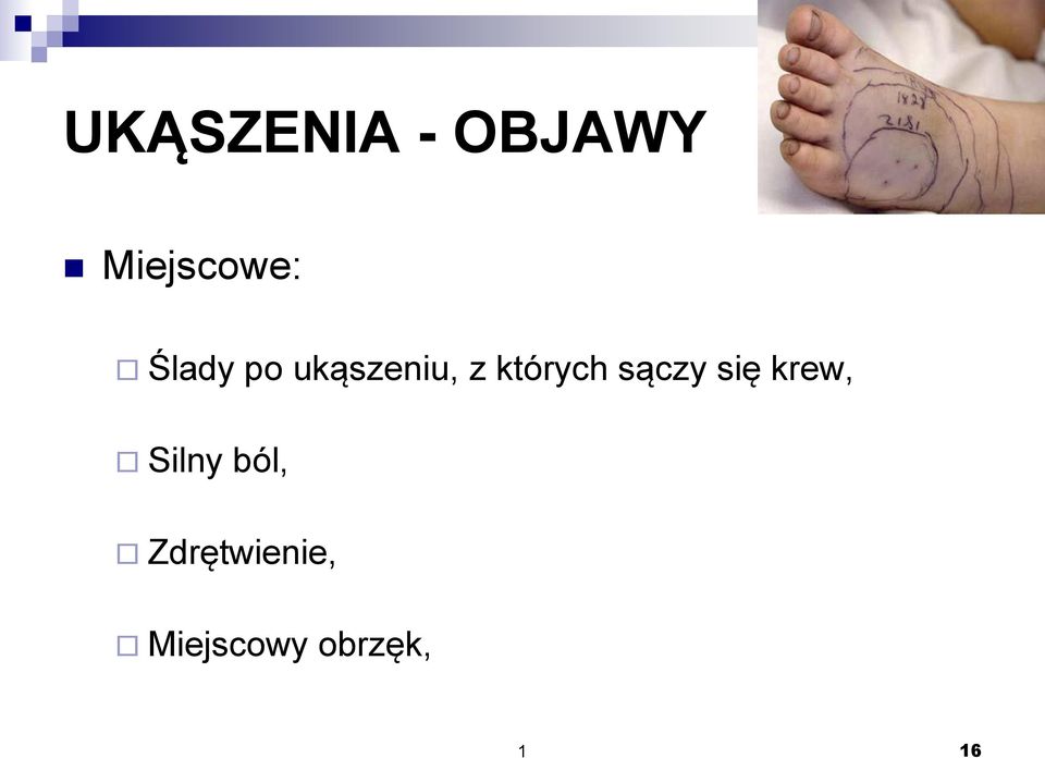 sączy się krew, Silny ból,