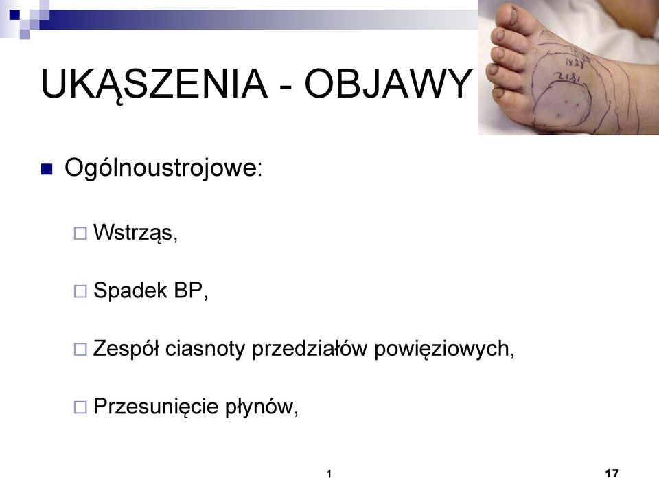 Spadek BP, Zespół ciasnoty