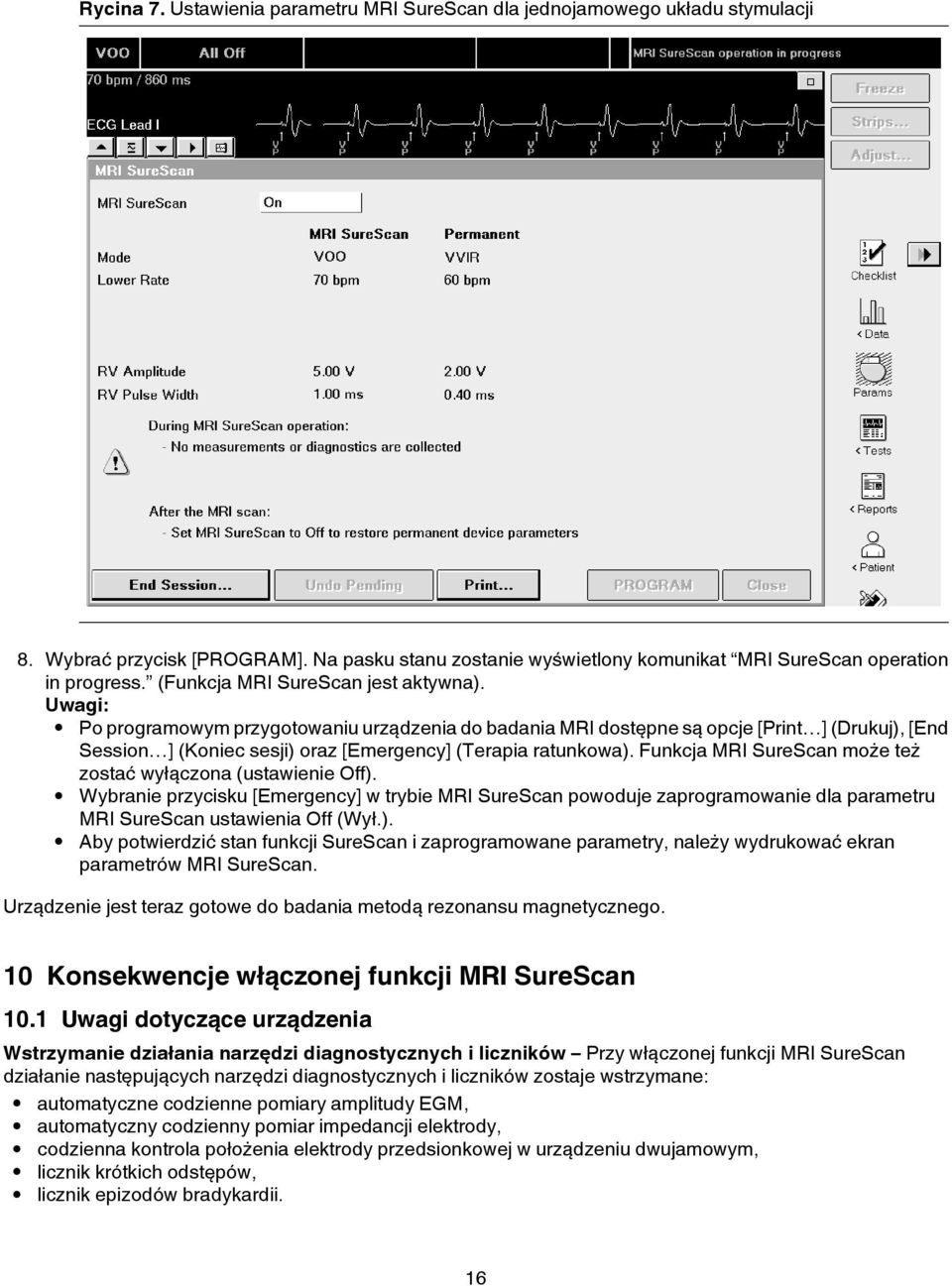 Uwagi: Po programowym przygotowaniu urządzenia do badania MRI dostępne są opcje [Print ] (Drukuj), [End Session ] (Koniec sesji) oraz [Emergency] (Terapia ratunkowa).