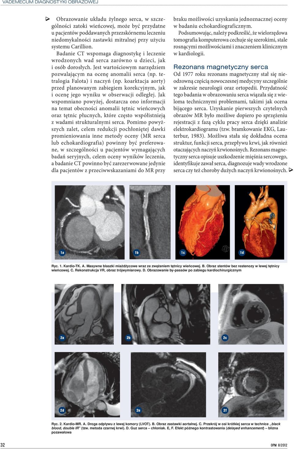 tetralogia Falota) i naczyń (np. koarktacja aorty) przed planowanym zabiegiem korekcyjnym, jak i ocenę jego wyniku w obserwacji odległej.