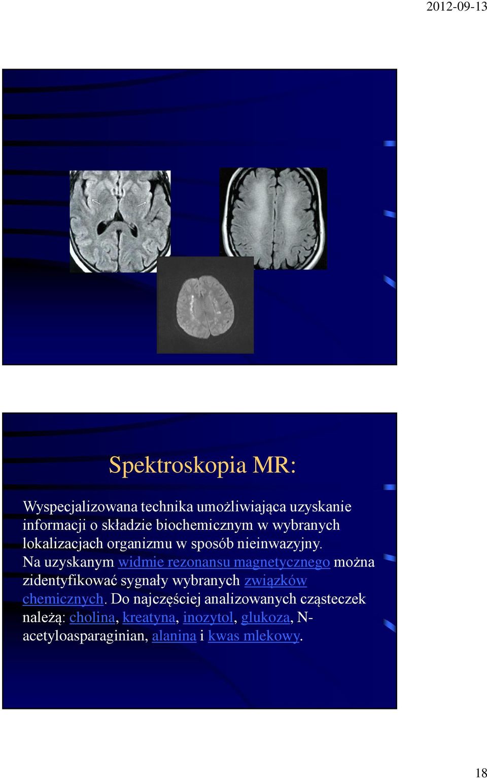 Na uzyskanym widmie rezonansu magnetycznego można zidentyfikować sygnały wybranych związków