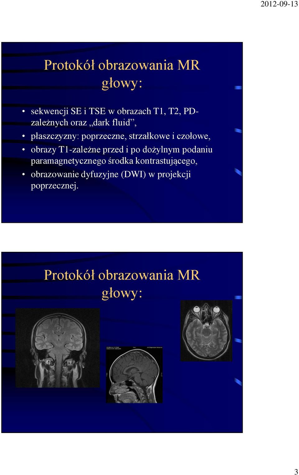 obrazy T1-zależne przed i po dożylnym podaniu paramagnetycznego środka