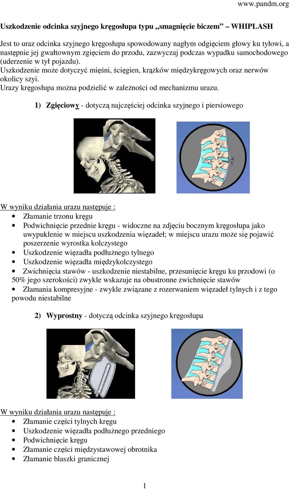 Urazy kręgosłupa można podzielić w zależności od mechanizmu urazu.