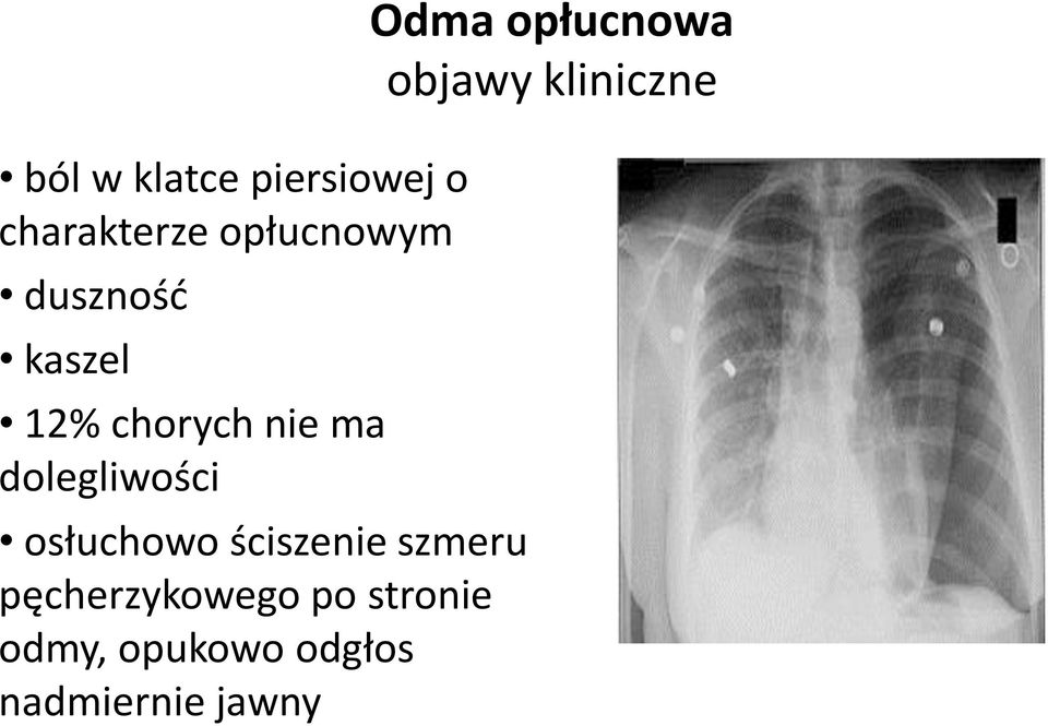 osłuchowo ściszenie szmeru pęcherzykowego po stronie