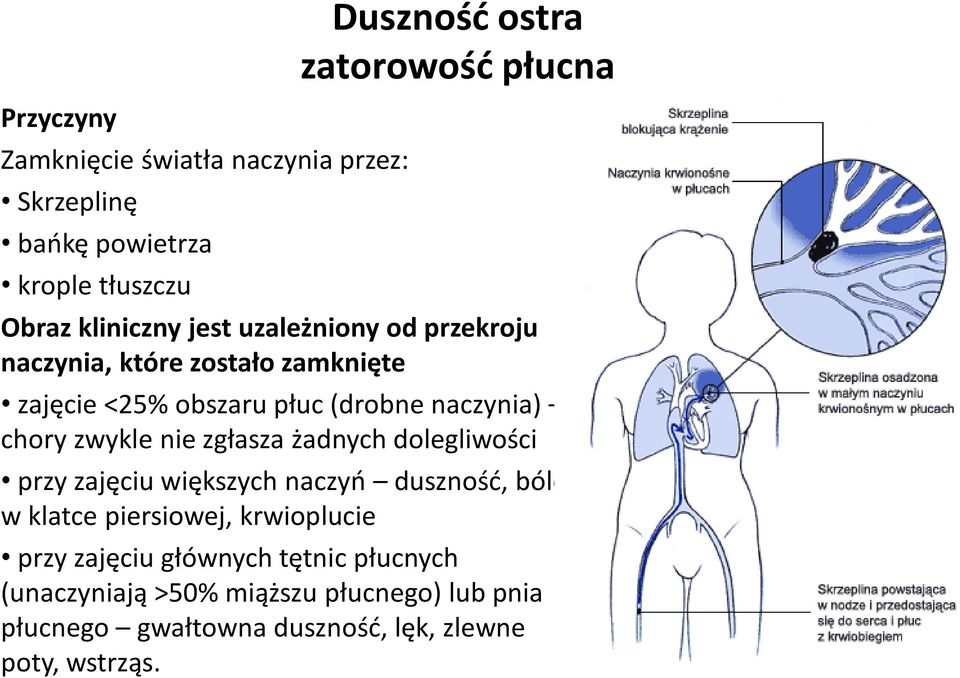 zwykle nie zgłasza żadnych dolegliwości przy zajęciu większych naczyń duszność, bóle w klatce piersiowej, krwioplucie przy