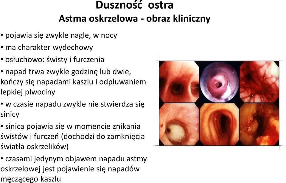 czasie napadu zwykle nie stwierdza się sinicy sinica pojawia się w momencie znikania świstów i furczeń (dochodzi do