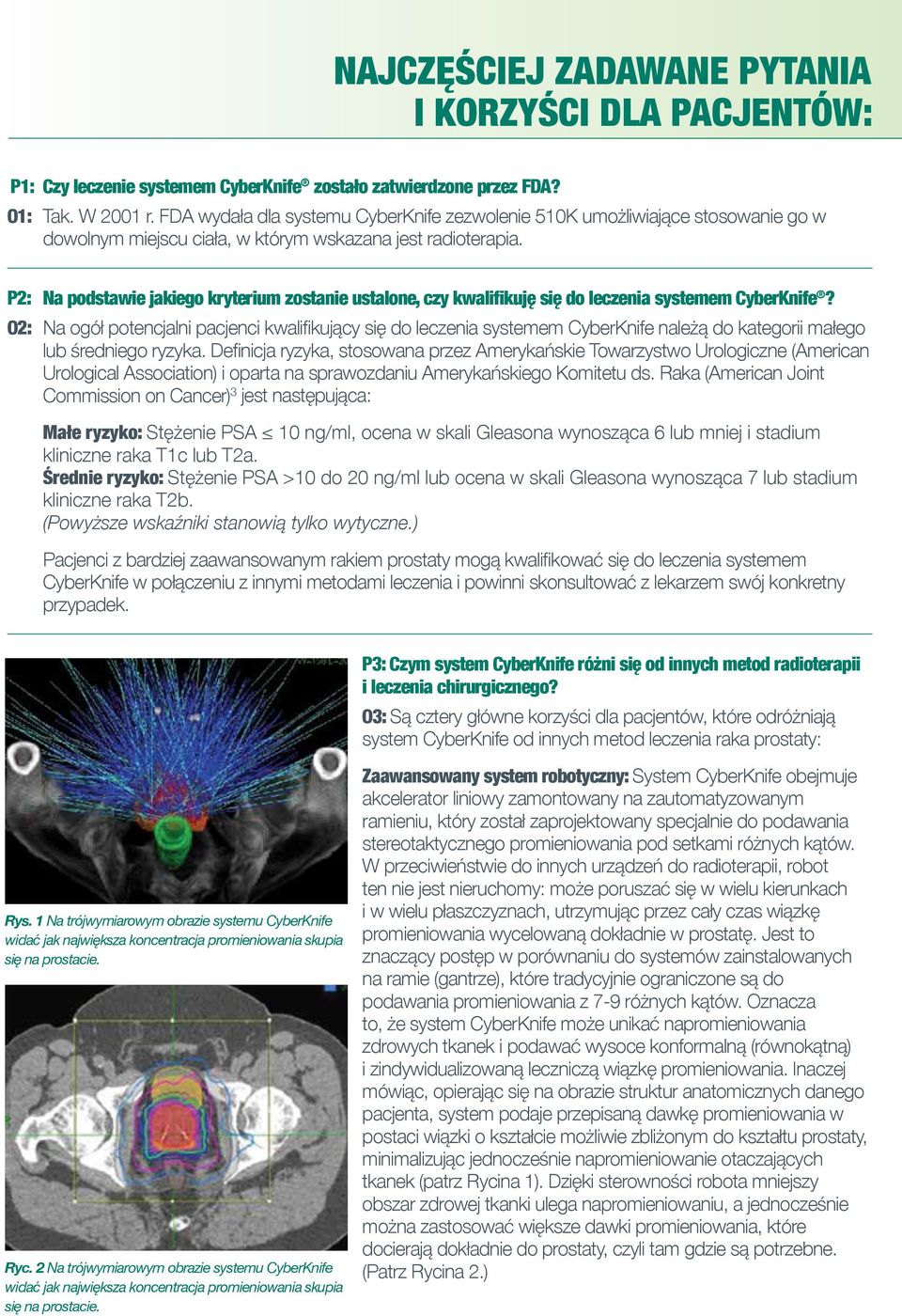 P2: Na podstawie jakiego kryterium zostanie ustalone, czy kwalifikuję się do leczenia systemem CyberKnife?