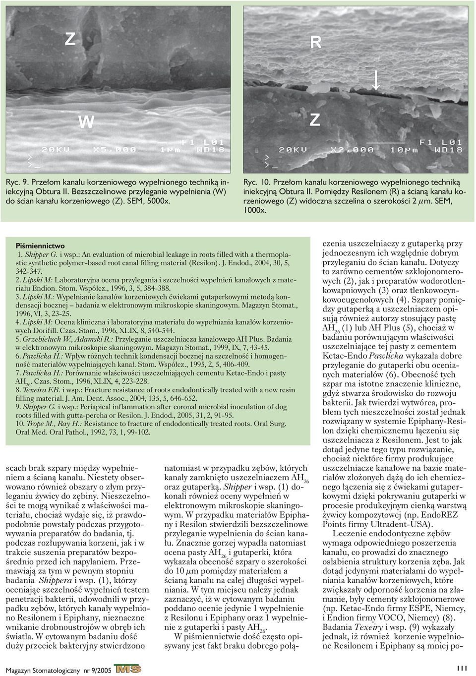 Shipper G. i wsp.: An evaluation of microbial leakage in roots filled with a thermoplastic synthetic polymer-based root canal filling material (Resilon). J. Endod., 20