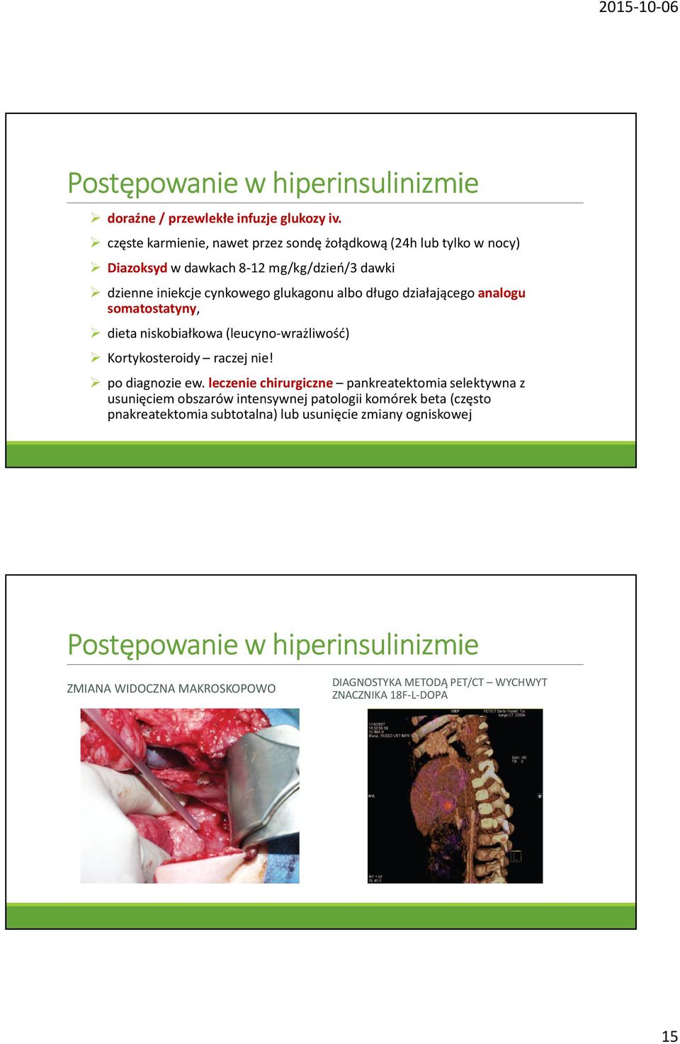 długodziałającego analogu somatostatyny, dieta niskobiałkowa(leucyno-wrażliwość) Kortykosteroidy raczej nie! po diagnozie ew.