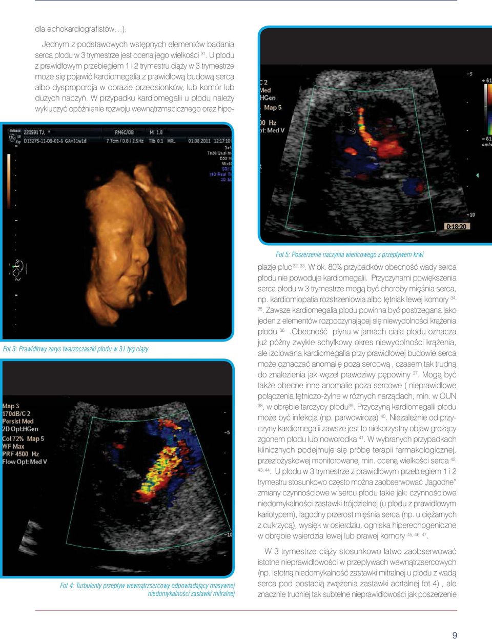 zastawki mitralnej Jednym z podstawowych wstępnych elementów badania serca płodu w 3 trymestrze jest ocena jego wielkości 31.