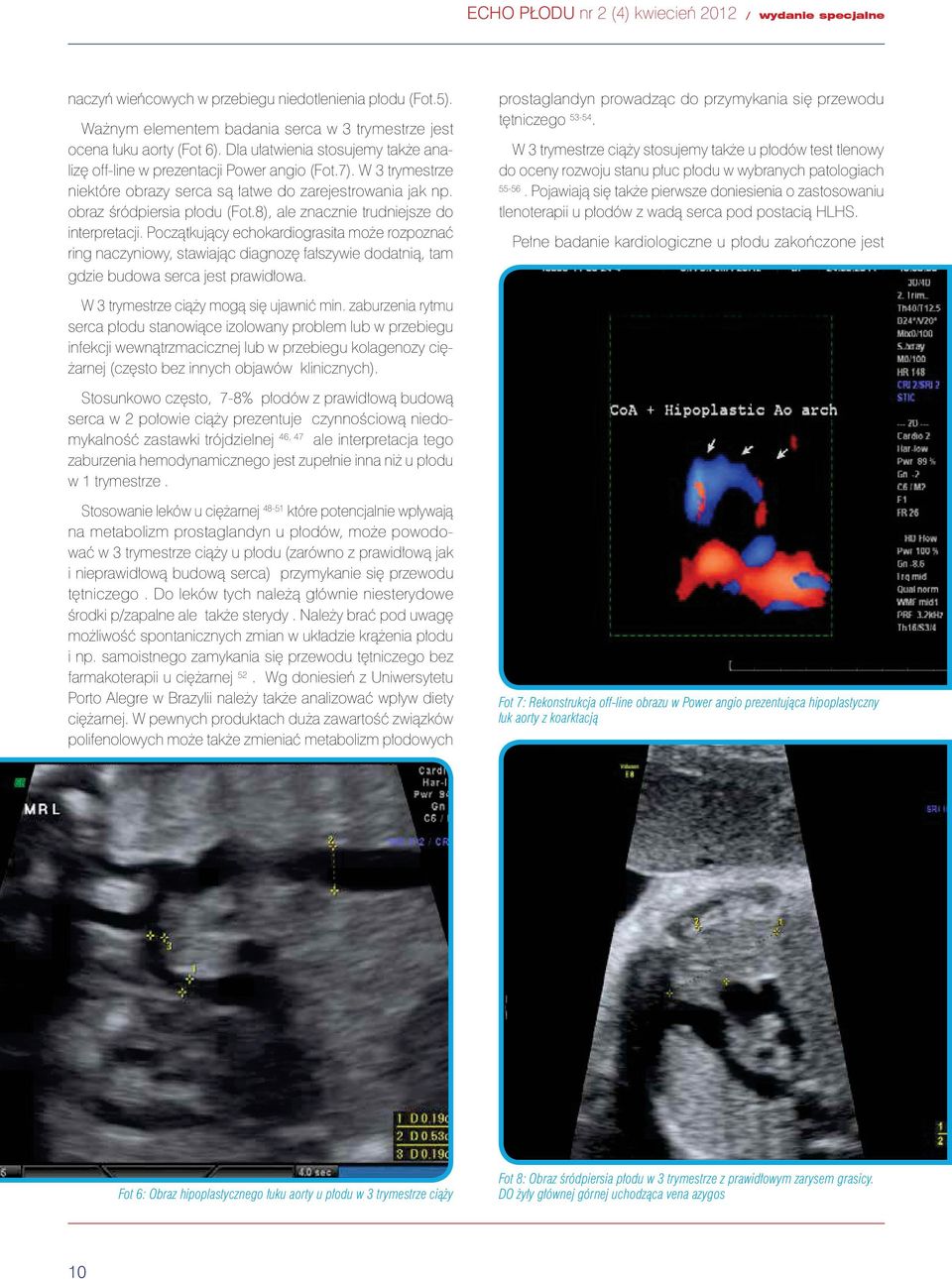 8), ale znacznie trudniejsze do interpretacji. Początkujący echokardiograsita może rozpoznać ring naczyniowy, stawiając diagnozę fałszywie dodatnią, tam gdzie budowa serca jest prawidłowa.