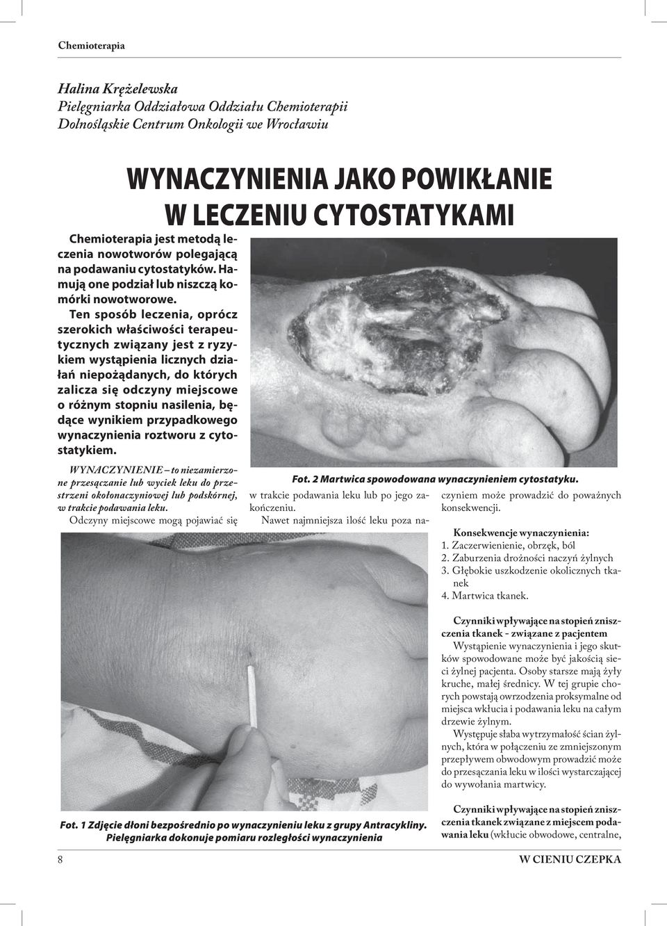 Ten sposób leczenia, oprócz szerokich właściwości terapeutycznych związany jest z ryzykiem wystąpienia licznych działań niepożądanych, do których zalicza się odczyny miejscowe o różnym stopniu