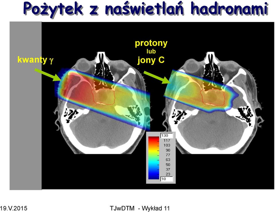 hadronami kwanty