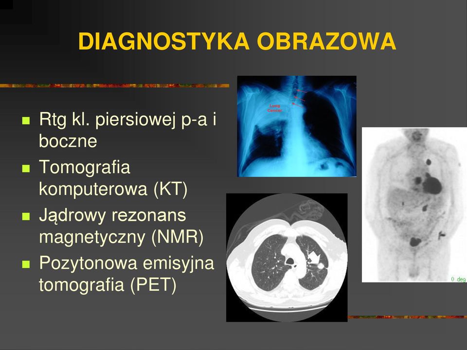 komputerowa (KT) Jądrowy rezonans