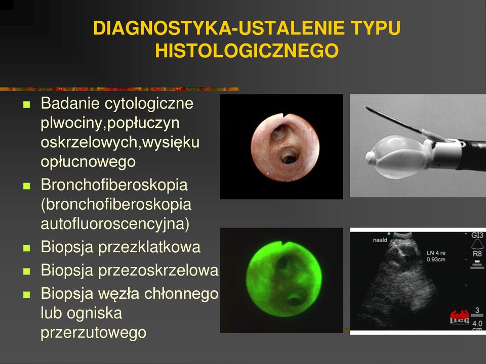 Bronchofiberoskopia (bronchofiberoskopia autofluoroscencyjna)