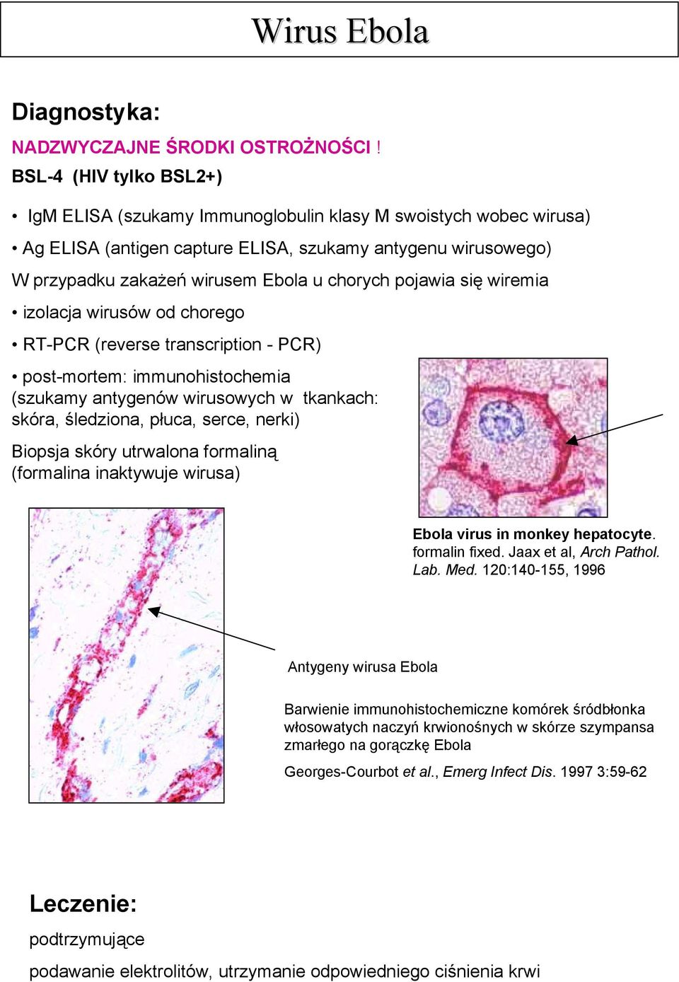 pojawia się wiremia izolacja wirusów od chorego RT-PCR (reverse transcription - PCR) post-mortem: immunohistochemia (szukamy antygenów wirusowych w tkankach: skóra, śledziona, płuca, serce, nerki)