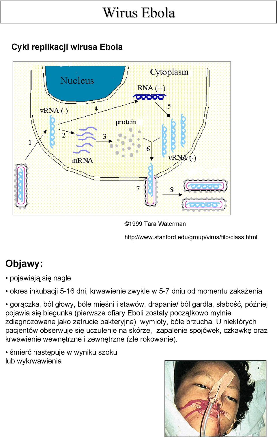 drapanie/ ból gardła, słabość, później pojawia się biegunka (pierwsze ofiary Eboli zostały początkowo mylnie zdiagnozowane jako zatrucie bakteryjne),