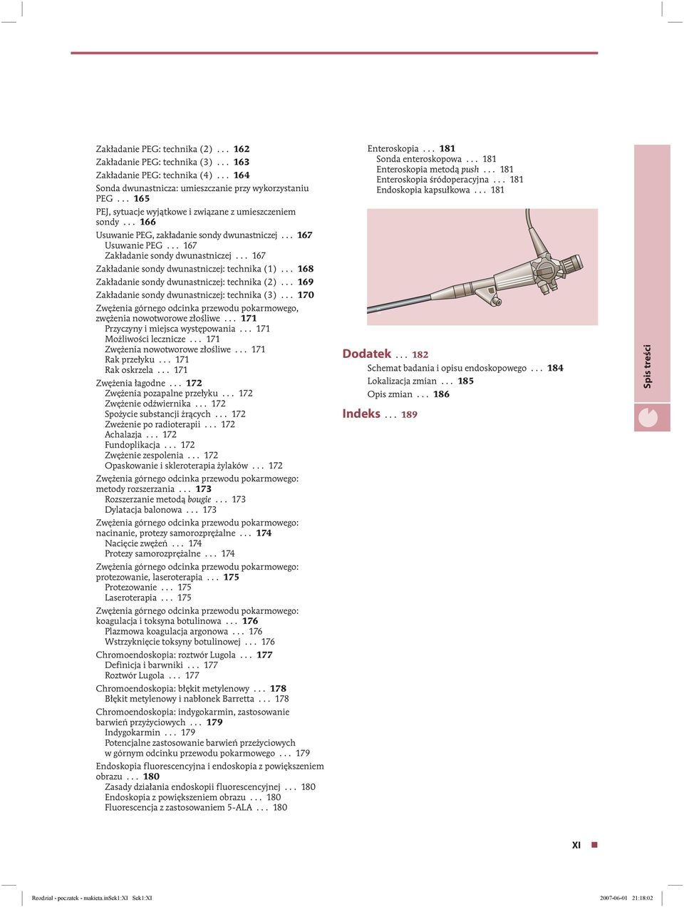 .. 167 Zakładanie sondy dwunastniczej: technika (1)... 168 Zakładanie sondy dwunastniczej: technika (2)... 169 Zakładanie sondy dwunastniczej: technika (3).