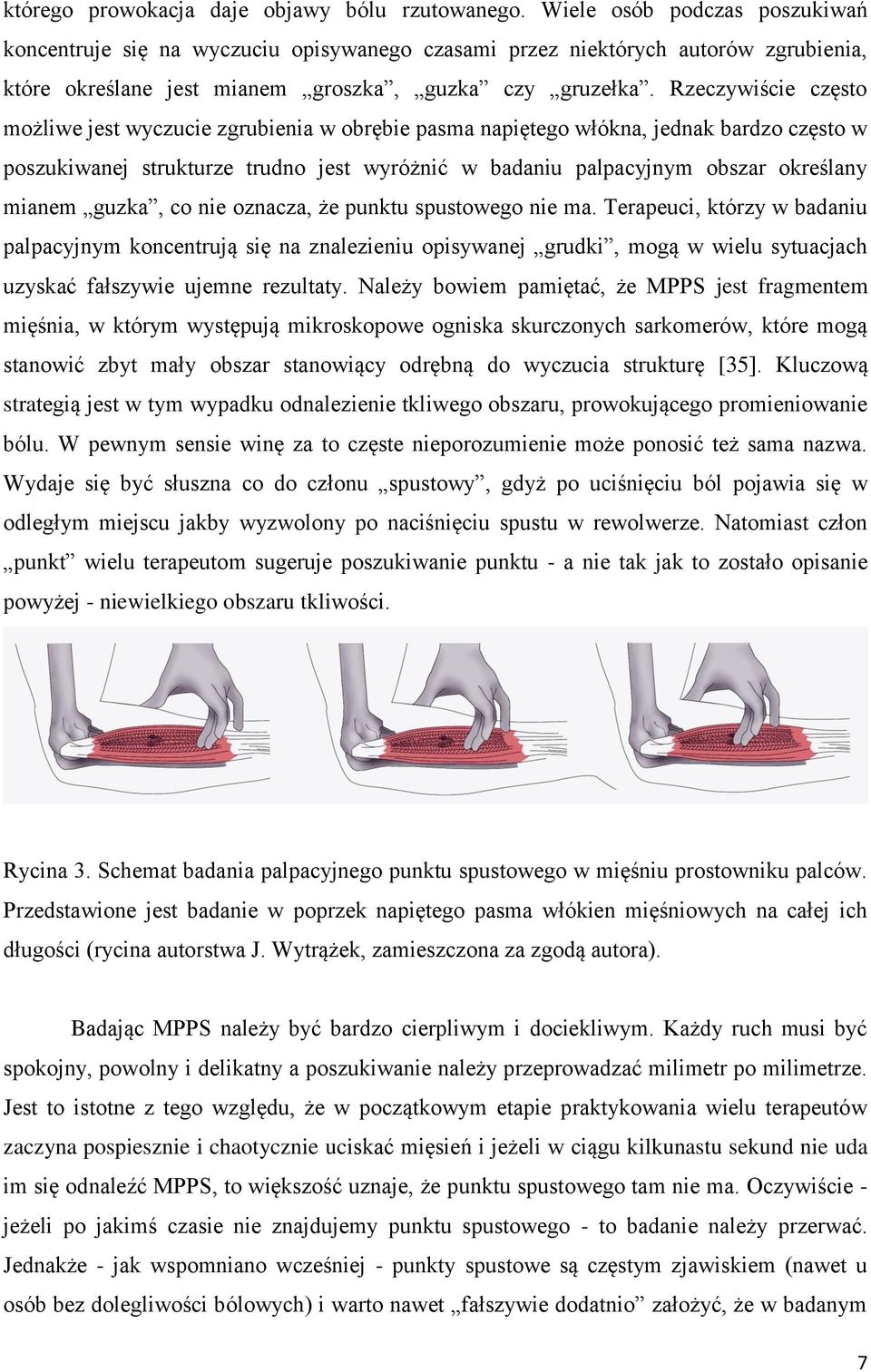 Rzeczywiście często możliwe jest wyczucie zgrubienia w obrębie pasma napiętego włókna, jednak bardzo często w poszukiwanej strukturze trudno jest wyróżnić w badaniu palpacyjnym obszar określany